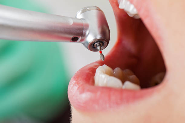 Best Tooth Pain Emergency Relief  in San Carlos Park, FL
